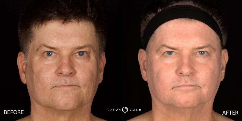 LASER DERMATOLOGY