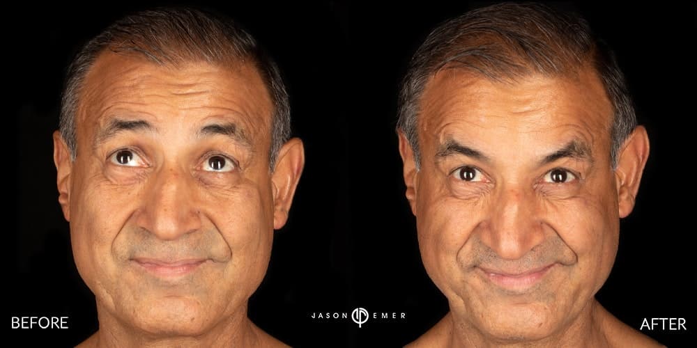 Patient before and after