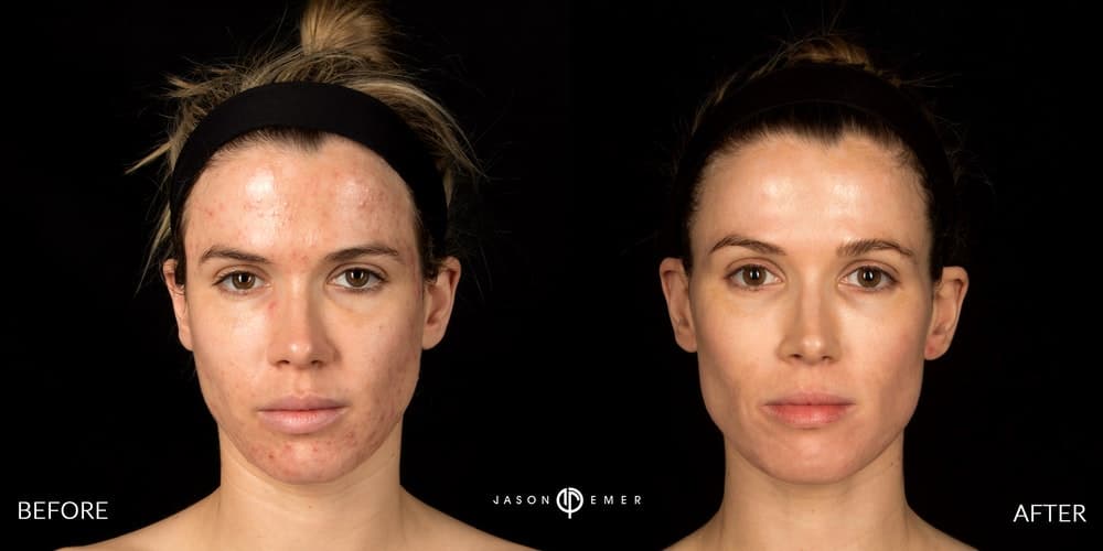 Patient before and after