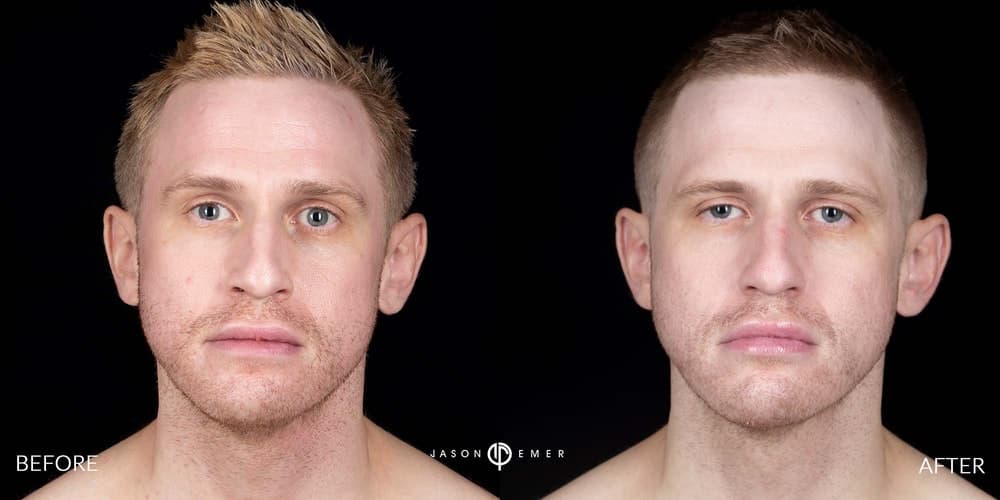 Patient before and after