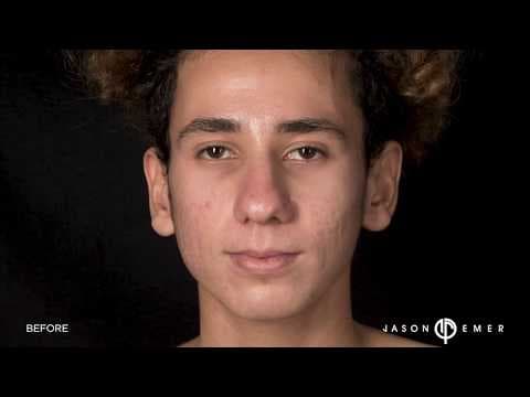 Patient story video 1