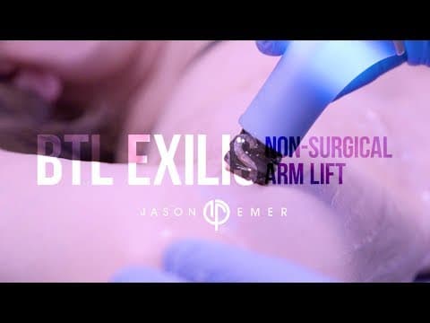 Patient story video 1