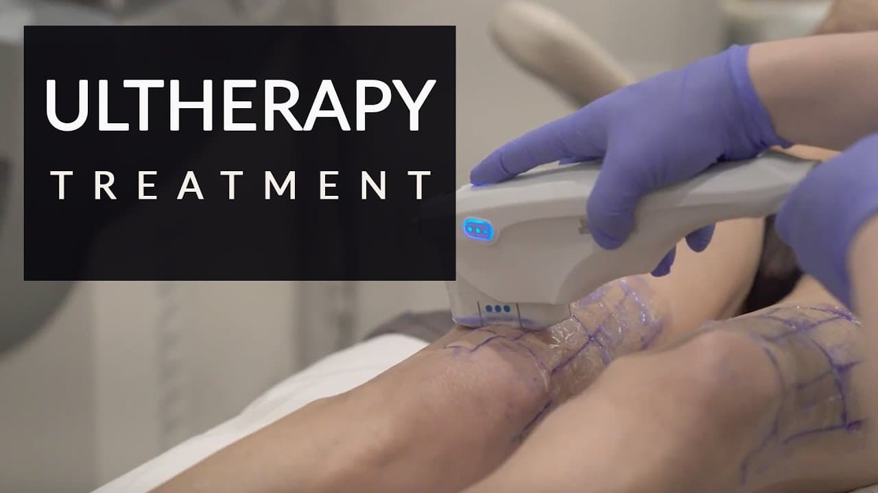 Patient story video 1