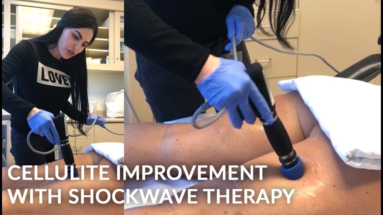 Patient story video 3
