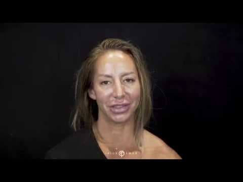 Patient story video 2
