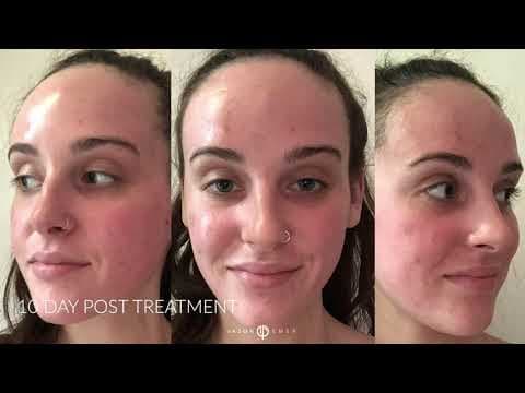 Patient story video 3