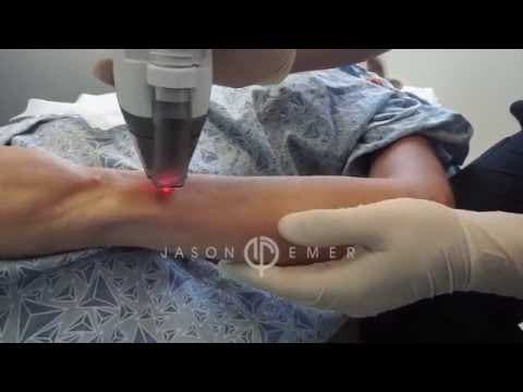Patient story video 3