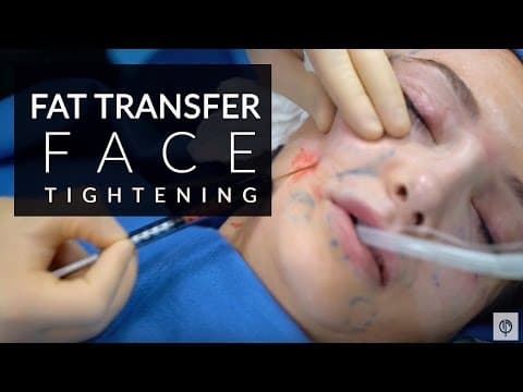 Patient story video 5