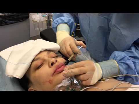 Patient story video 5