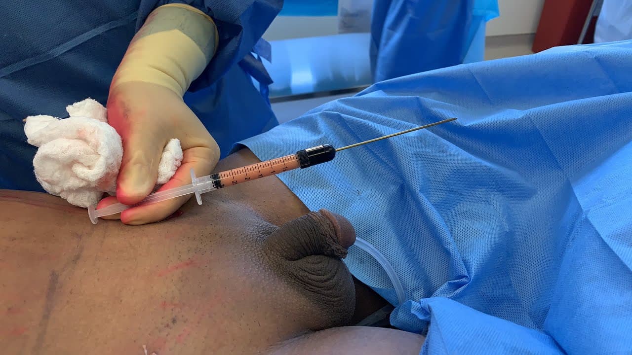 Patient story video 2