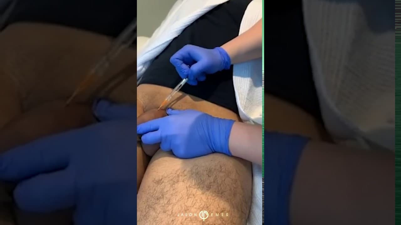 Patient story video 10