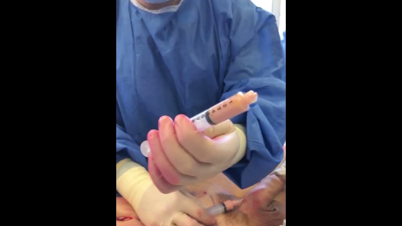 Patient story video 11