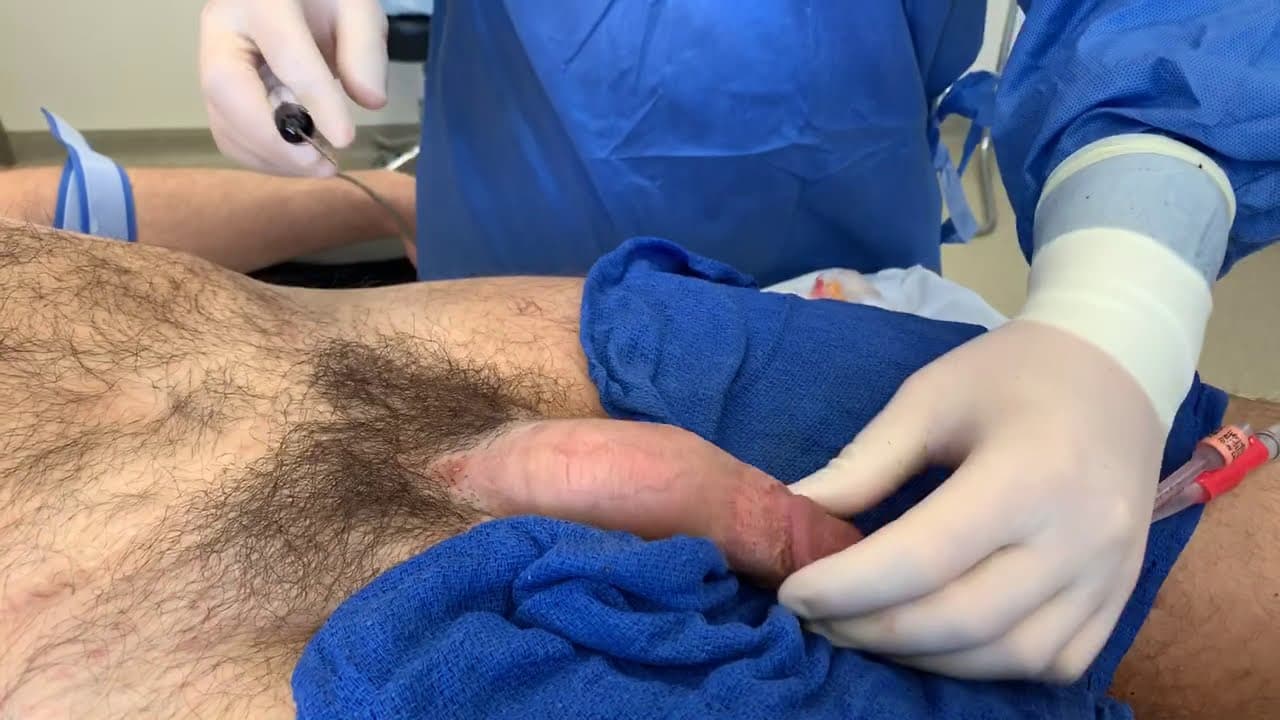 Patient story video 6
