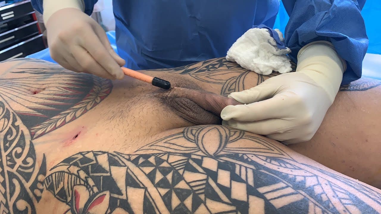 Patient story video 8