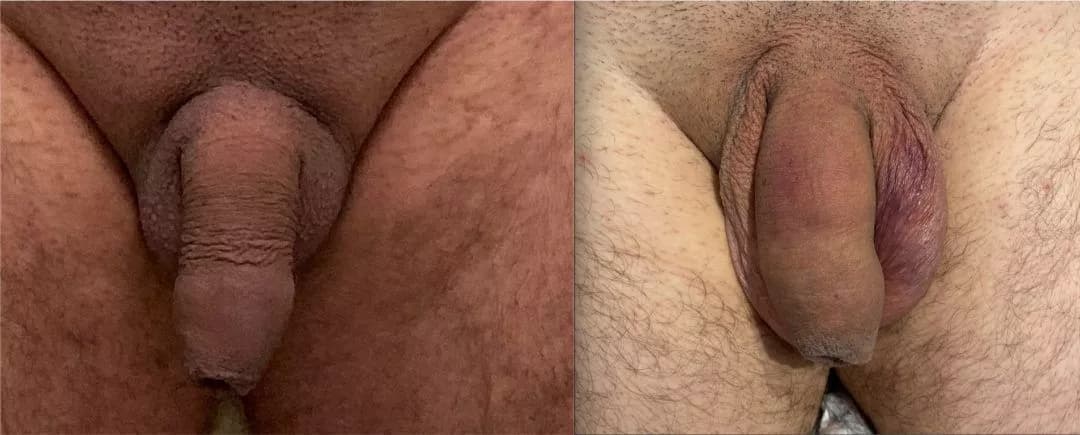 Patient 240297
