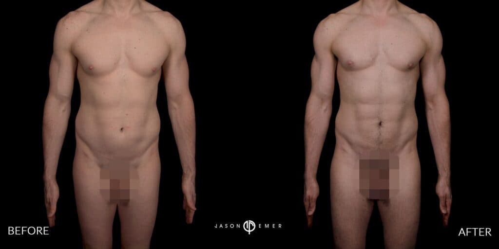 Patient before and after