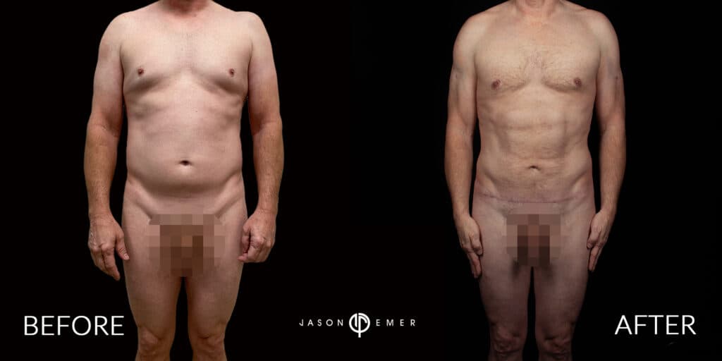 Patient before and after