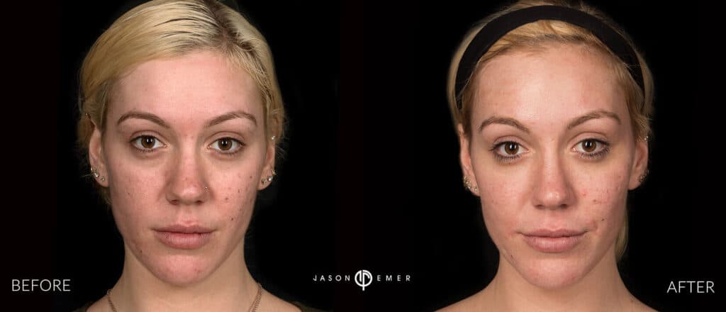 Patient before and after