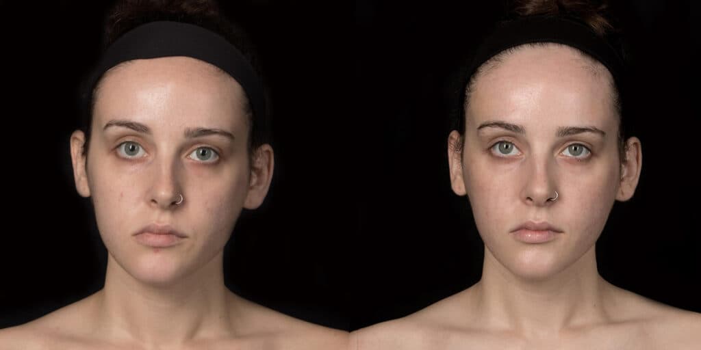 Patient before and after