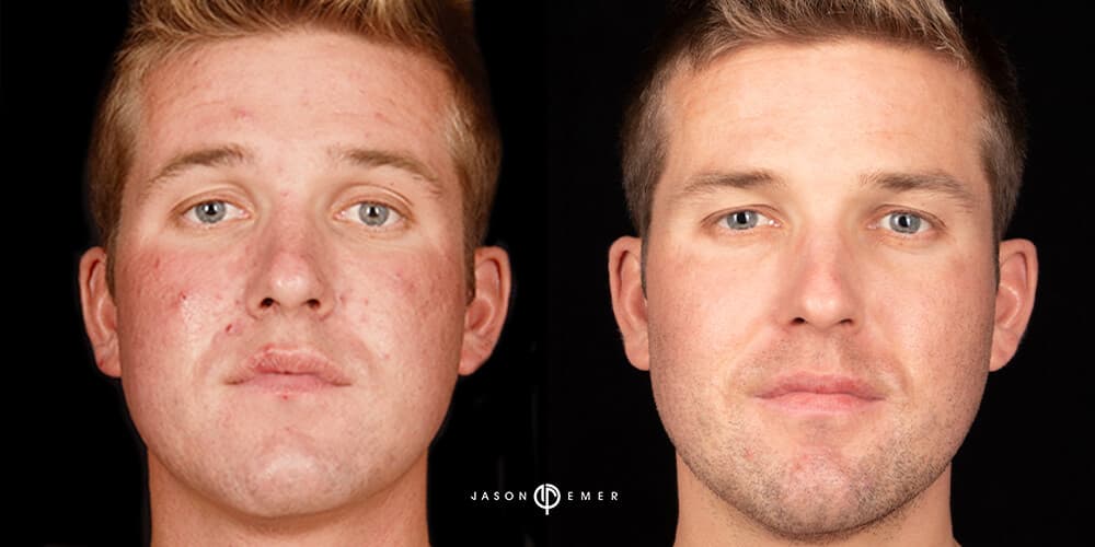 Patient before and after