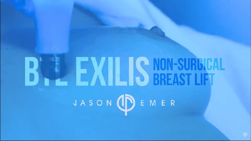 BTL EXILIS ULTRA