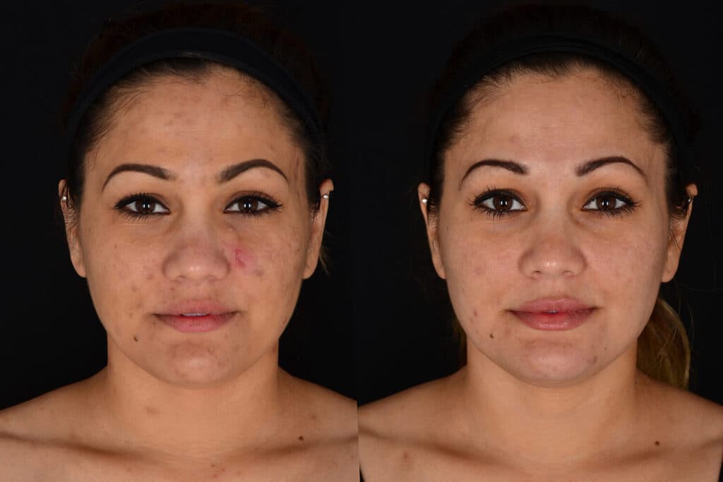 Patient before and after