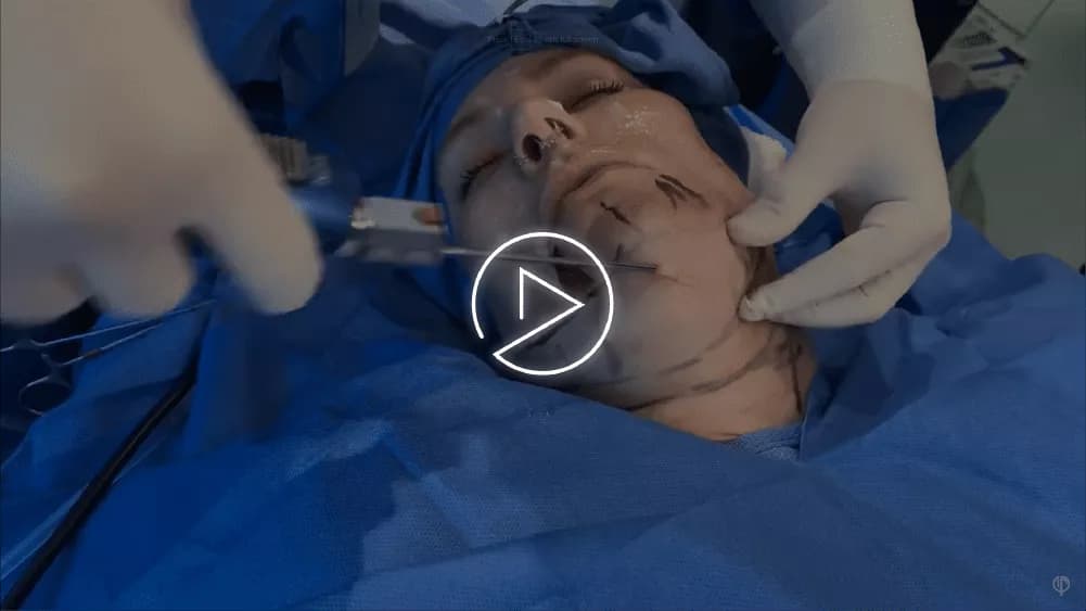 Chin and jawline surgery editorial composite