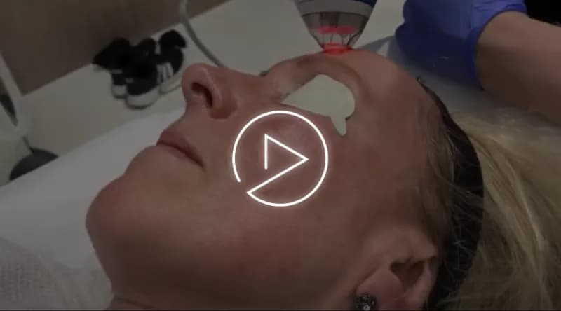 aging skin & sun spots