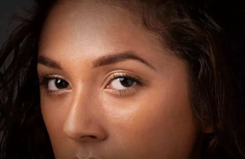 Endoscopic Brow Lift
