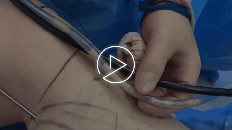Dr. Jason Emer, board-certified dermatologist who performs Calf Sculpting for Men