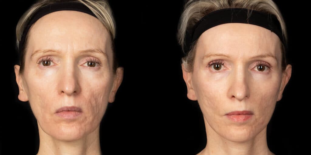 Patient before and after
