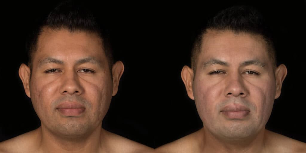 Patient before and after