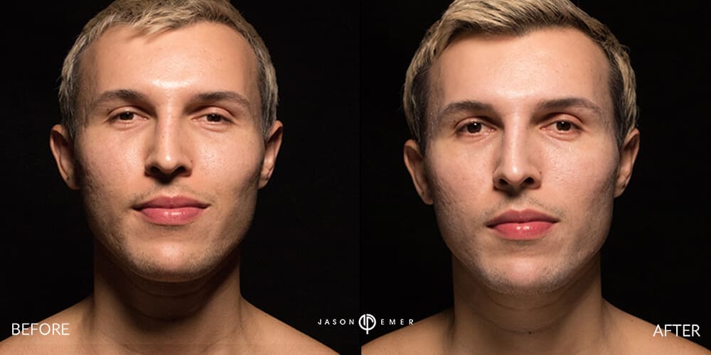 Patient before and after