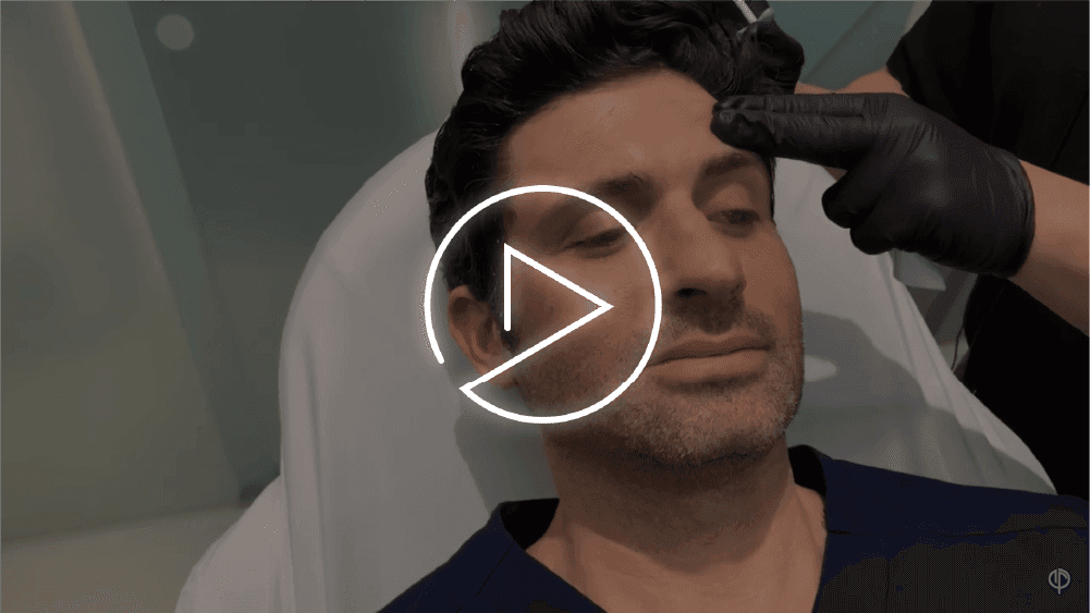 Juvederm