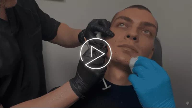 MALE FACIAL SCULPTING