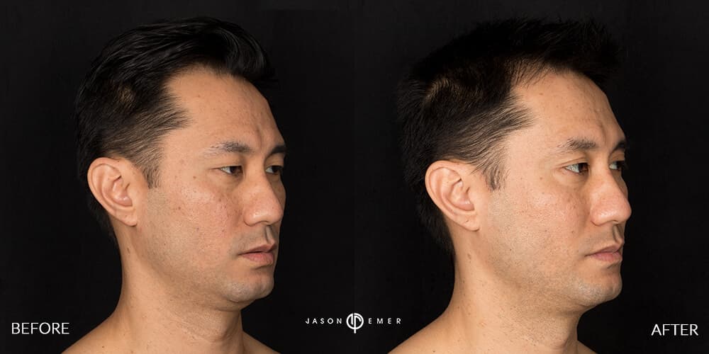 Michael Fujioka BA3