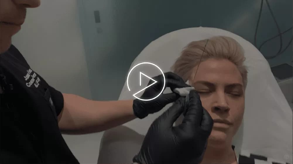 FEMALE FACIAL SCULPTING