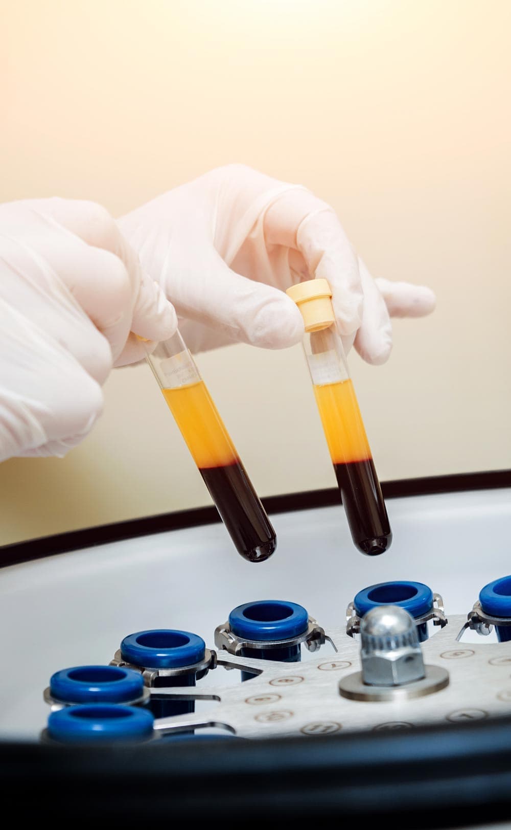 Regenerative medicine