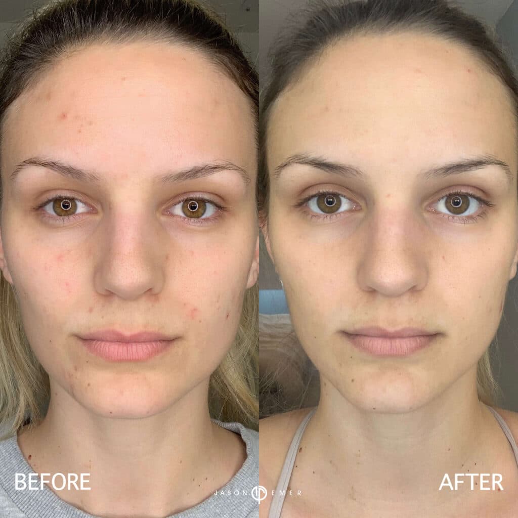Patient before and after