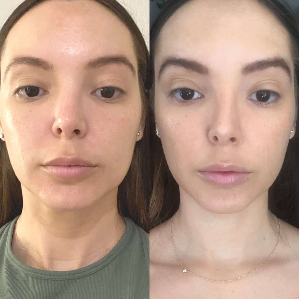 Patient before and after
