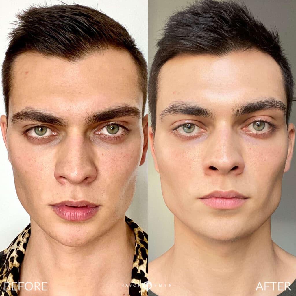 Patient before and after