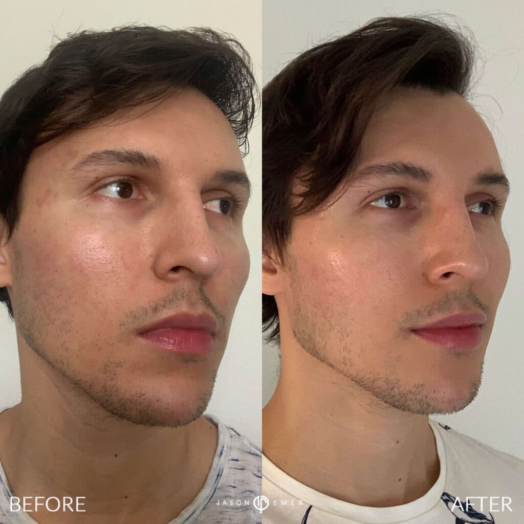 Patient before and after