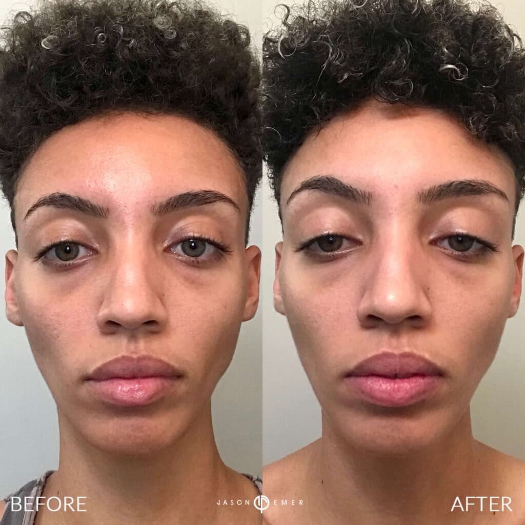 Patient before and after