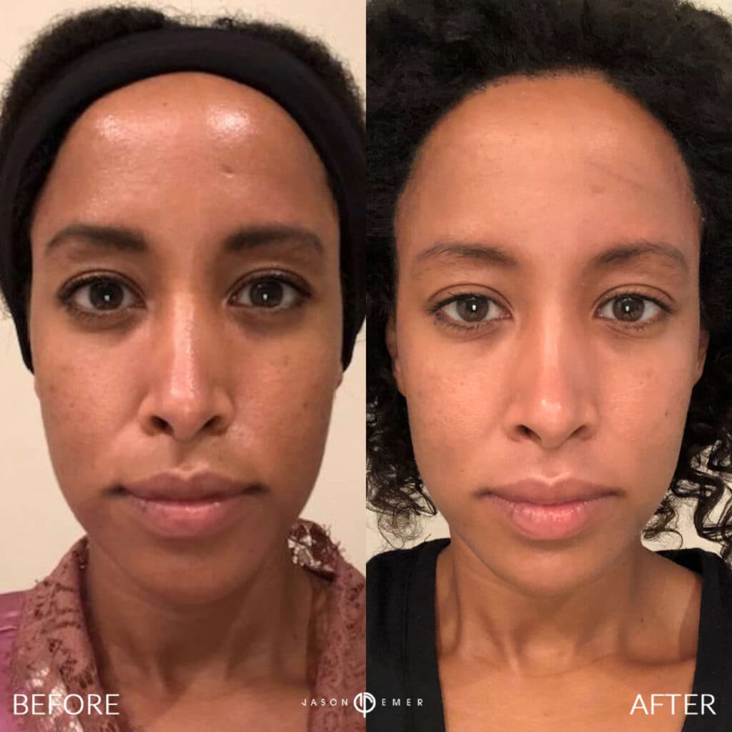 Patient before and after