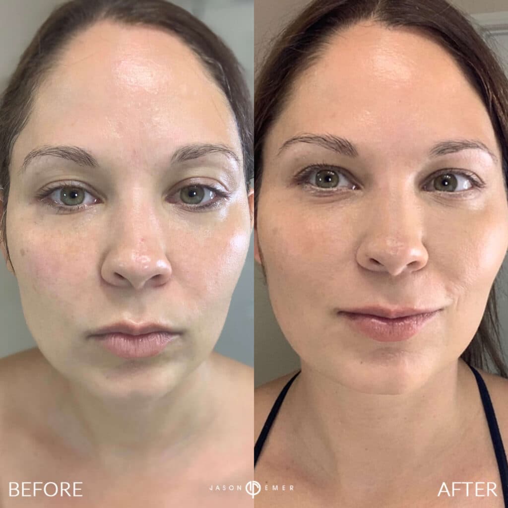 Patient before and after