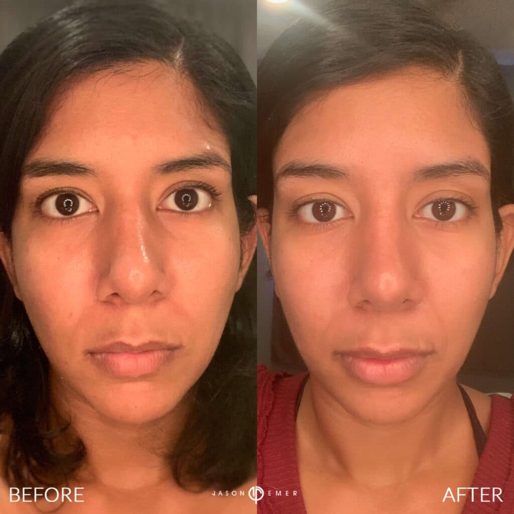 Patient before and after