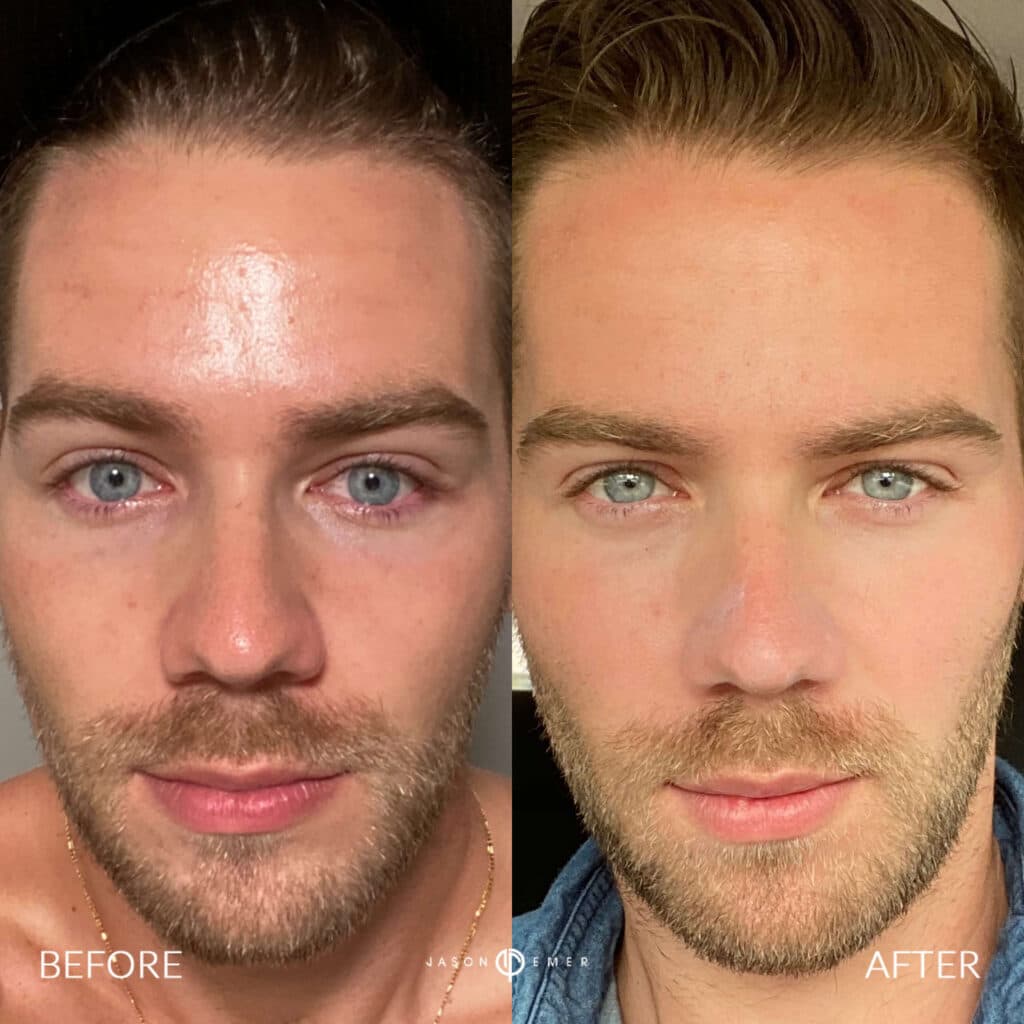Patient before and after