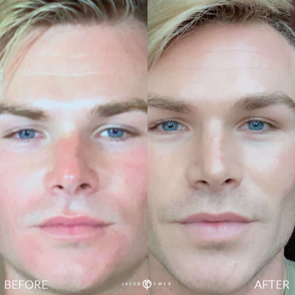 Patient before and after