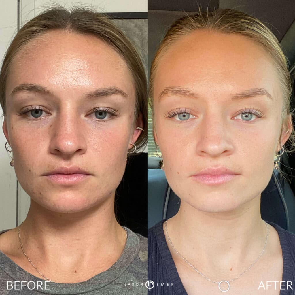 Patient before and after