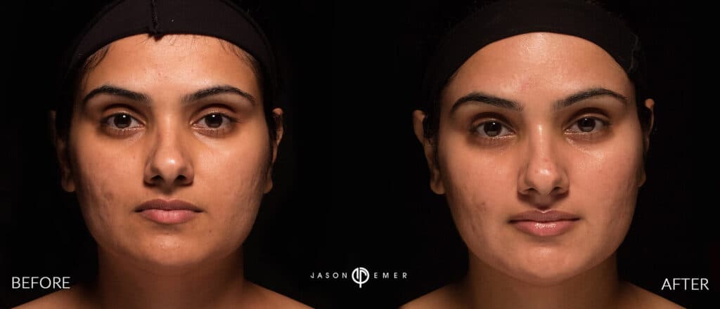 Patient before and after